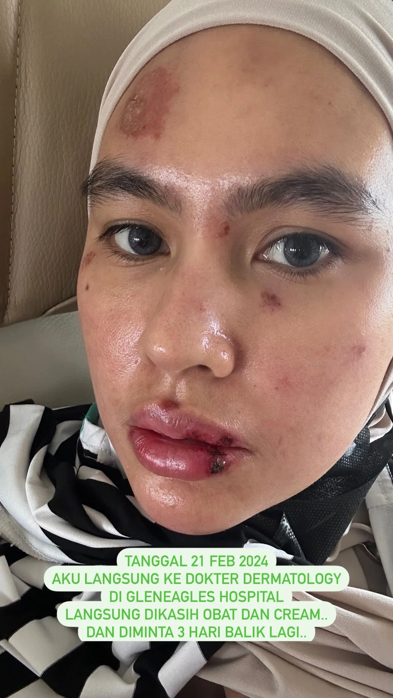 Menderita Penyakit Misterius, Kartika Putri Berobat ke Singapura